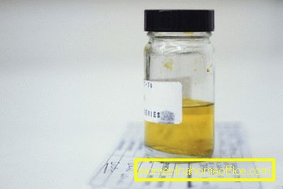 Analisi delle urine usando il metodo di Nechyporenko