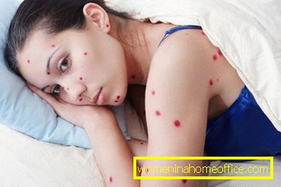 Cosa è pericoloso per la varicella per un adulto?